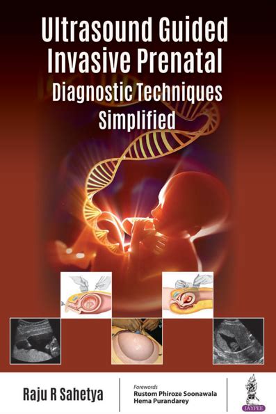 invasive prenatal diagnosis pdf.